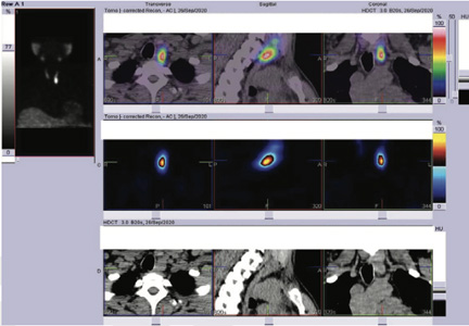 Endocrinology