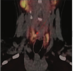 Endocrinology