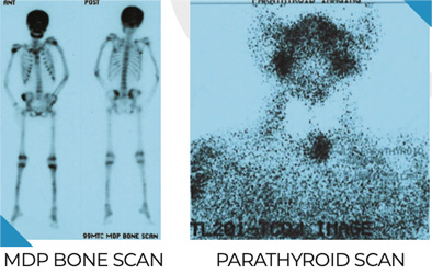 Endocrinology