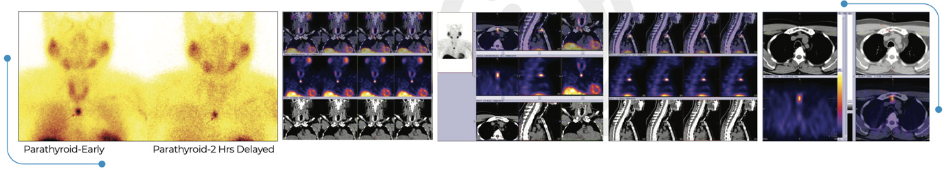 Endocrinology
