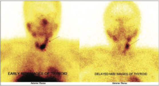 Endocrinology