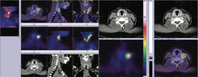 Endocrinology