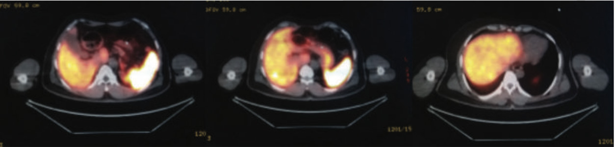 Endocrinology