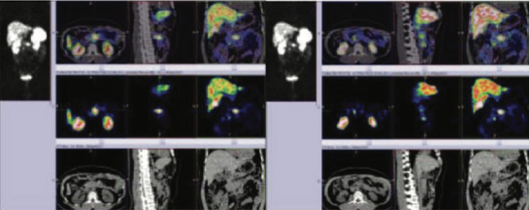 Endocrinology