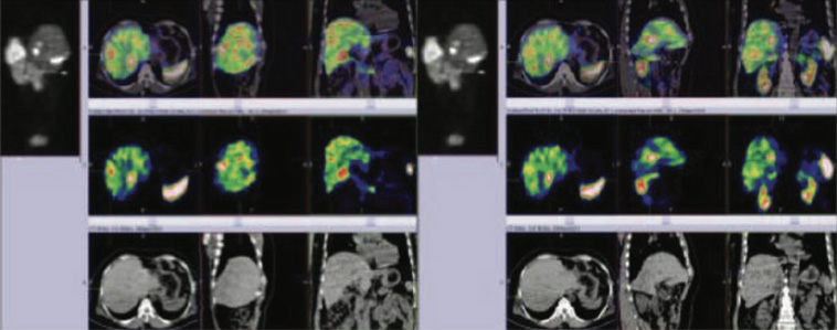 Endocrinology