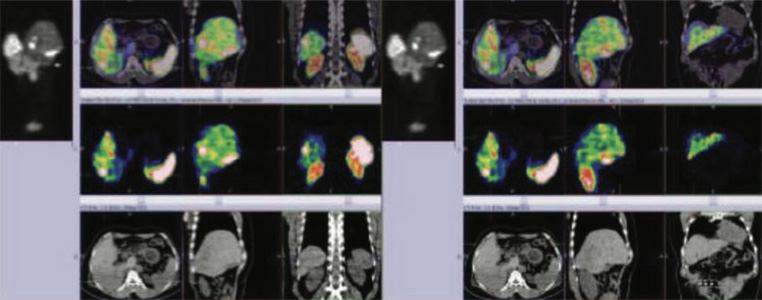 Endocrinology