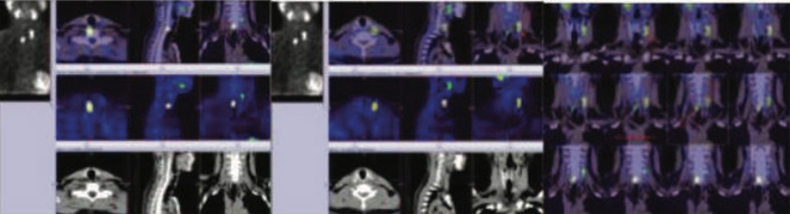 Endocrinology