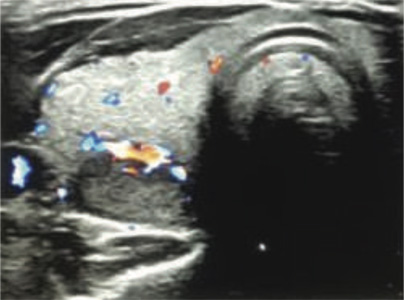 Endocrinology