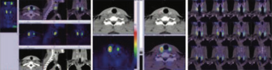 Endocrinology