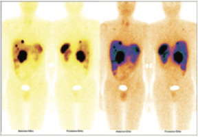 Endocrinology