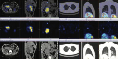 Endocrinology