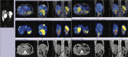 Endocrinology