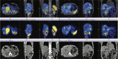 Endocrinology