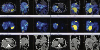 Endocrinology