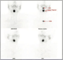 Endocrinology