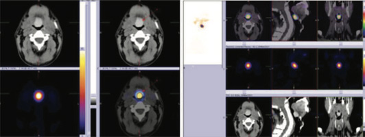 Endocrinology