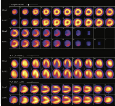 Cardiology