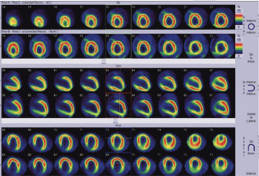 Cardiology