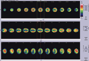 Cardiology
