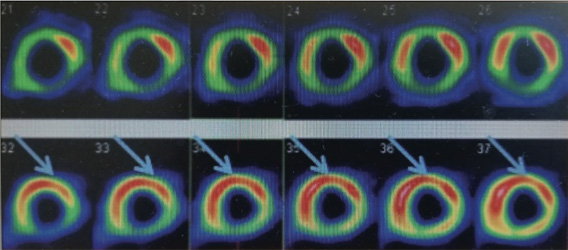 Cardiology