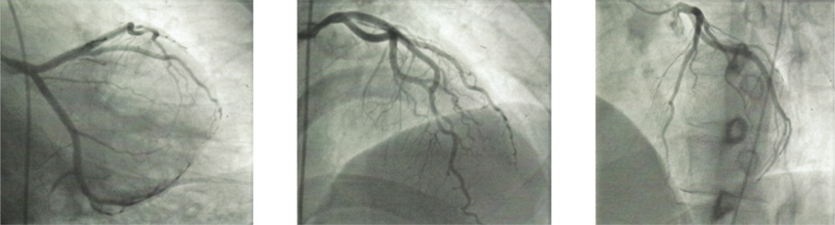 Cardiology