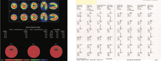 Cardiology
