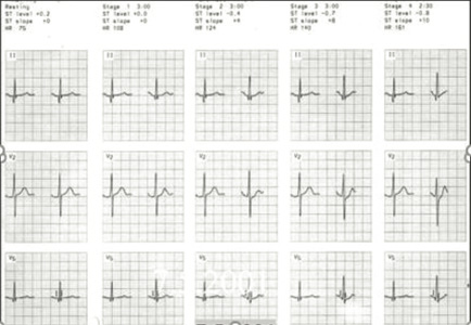 Cardiology