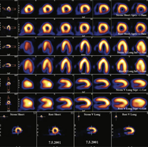 Cardiology