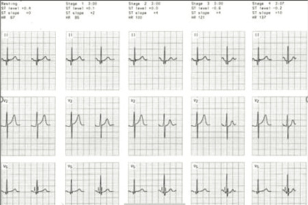 Cardiology