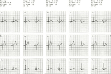 Cardiology
