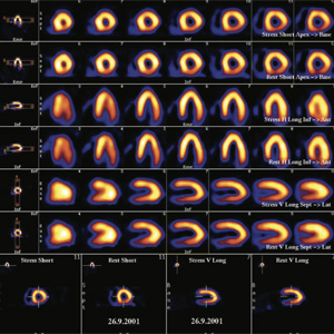 Cardiology