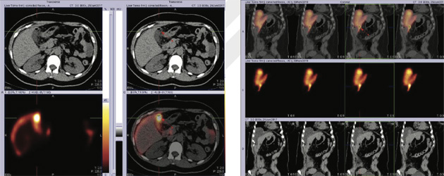 Gastroenterology