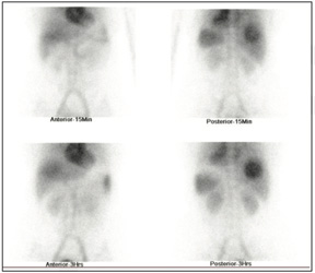 Gastroenterology