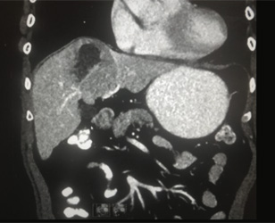 Gastroenterology