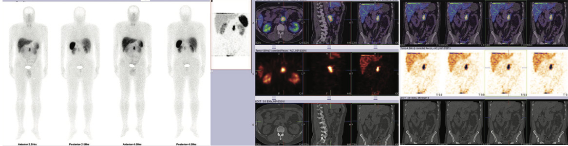 Neuro-Endocrinology