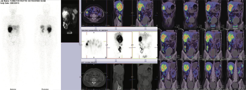 Neuro-Endocrinology