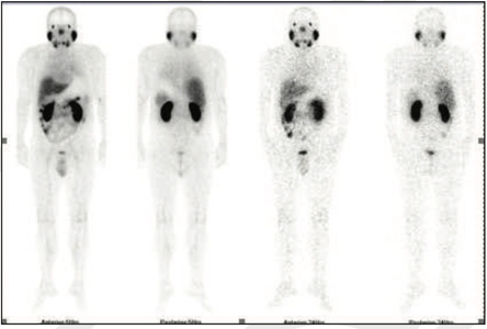 Oncology