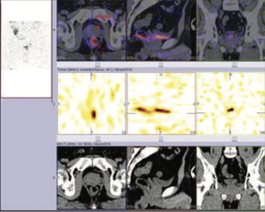 Oncology