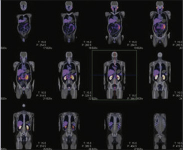 Oncology