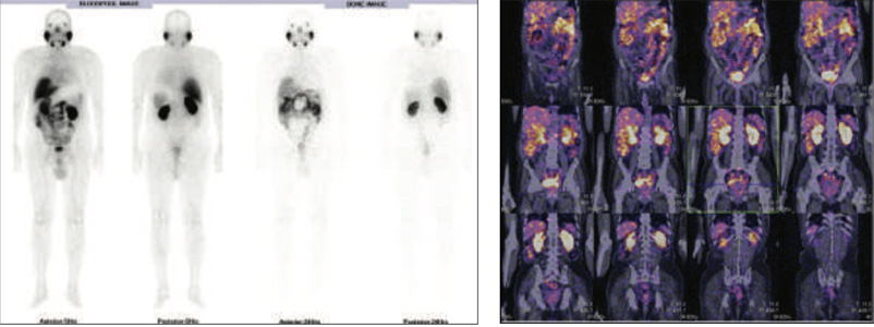 Oncology