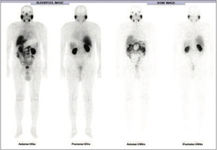 Oncology