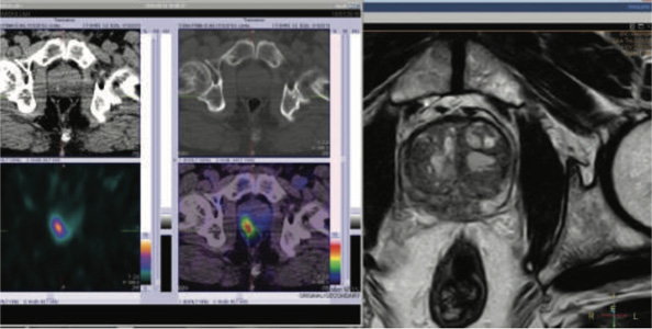 Oncology