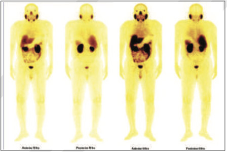 Oncology