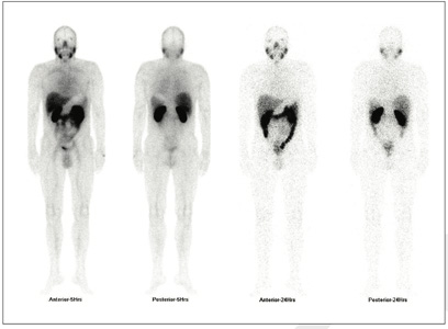 Oncology