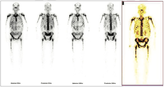 Oncology