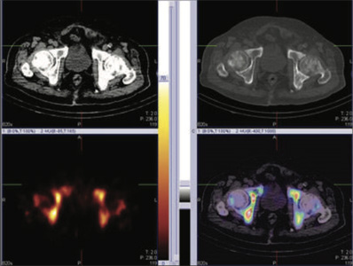 Oncology
