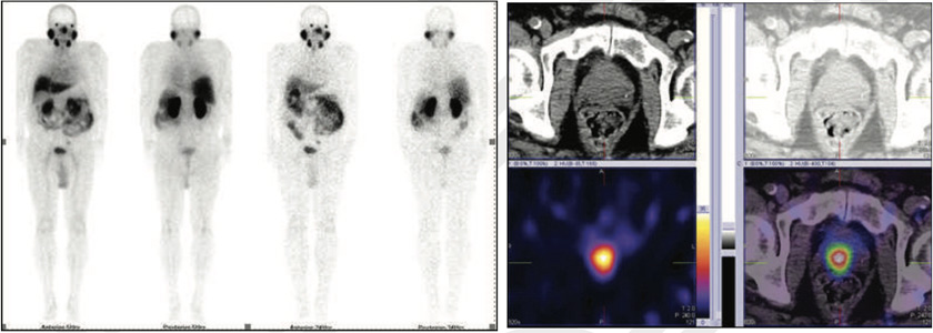 Oncology