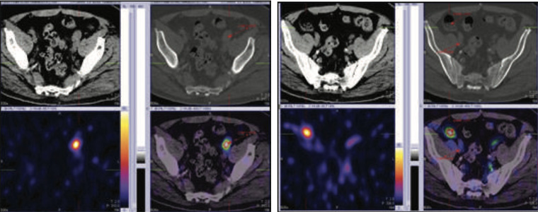 Oncology