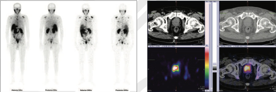 Oncology