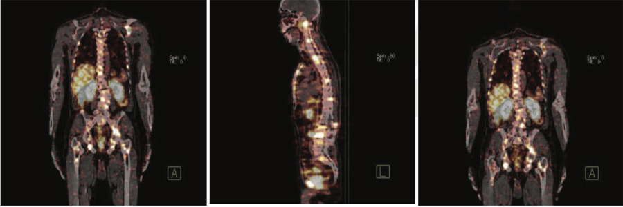 Oncology